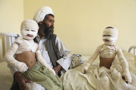 Фотограф запечатлел шокирующие последствия военных операций в Афганистане