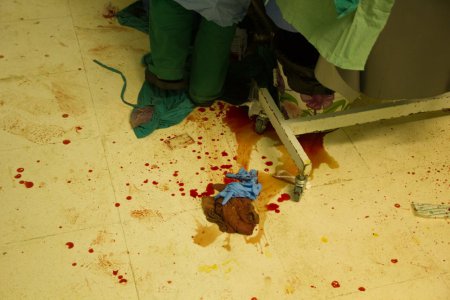 Кровавая ночь в Африне: после турецкого обстрела убиты и ранеными дети, в больнице идут операции (ФОТО, ВИДЕО18)