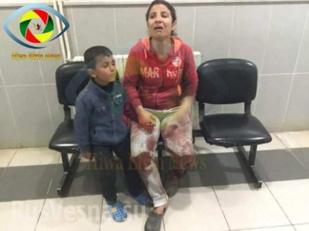 Кровавая ночь в Африне: после турецкого обстрела убиты и ранеными дети, в больнице идут операции (ФОТО, ВИДЕО18)