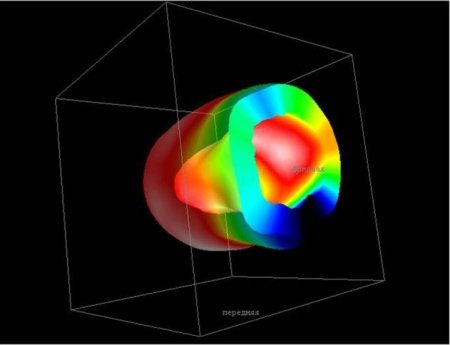 Отечественный двухдетекторный однофотонный гамма-томограф Эфатом разработки АО НИИЭФА Медицина и Фармацевтика
