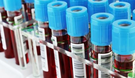 Ученые: Найден способ быстрого обнаружения наркотиков в крови