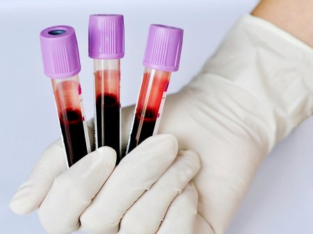 Учёные рассказали, как группа крови влияет на смертность после тяжёлых травм