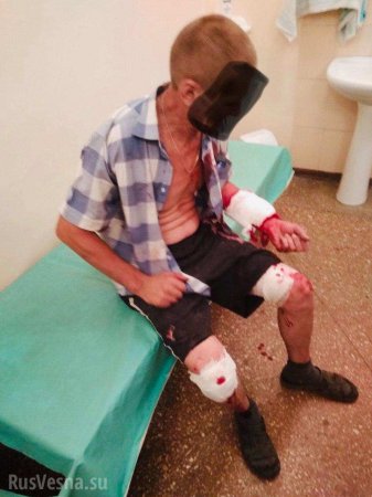 ВСУ нанесли удар по Зайцево, ранен мирный житель (ФОТО)