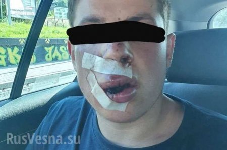 Студента из Украины жестоко избили в Польше (ФОТО)