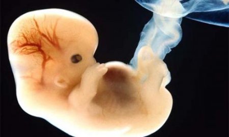 Российские ученые научились диагностировать патологии мозга у эмбриона