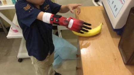 Российские ученые изобрели бионический протез для детей